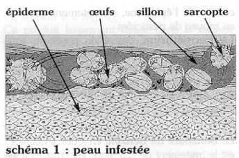 Stromectol Sans Ordonnance Belgique