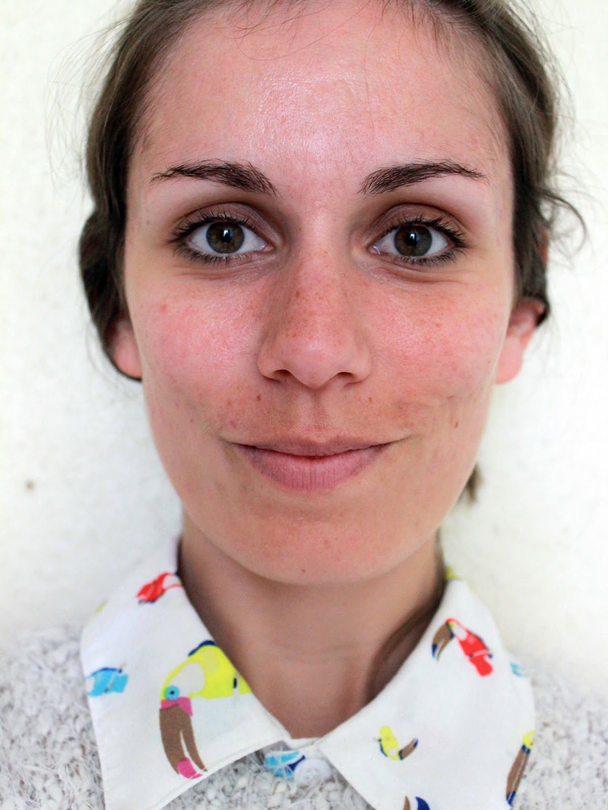Roaccutane sans pilule