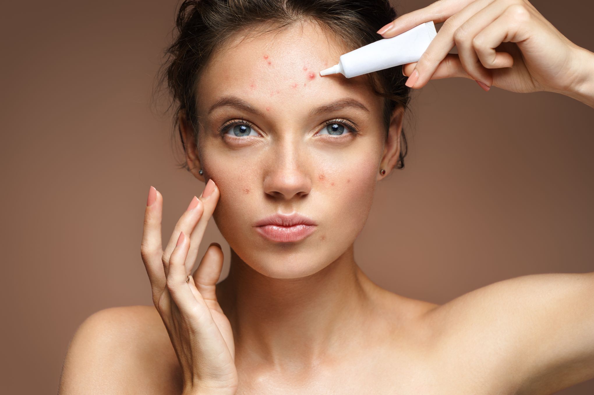 Roaccutane gel france