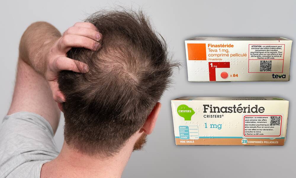 Finasteride 5mg cheveux prix