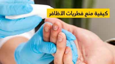 Coût diflucan