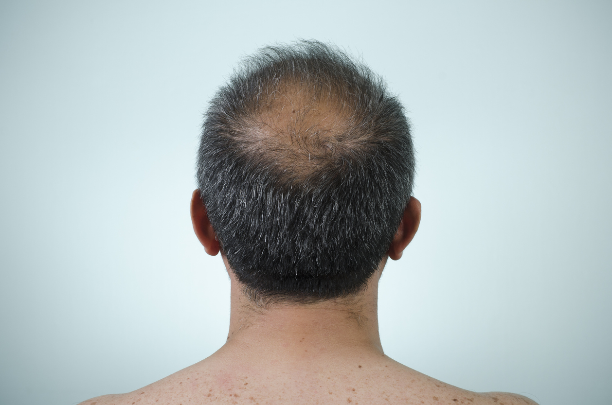 Finasteride Bon Marché