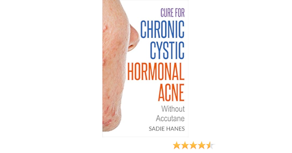Accutane comment acheter