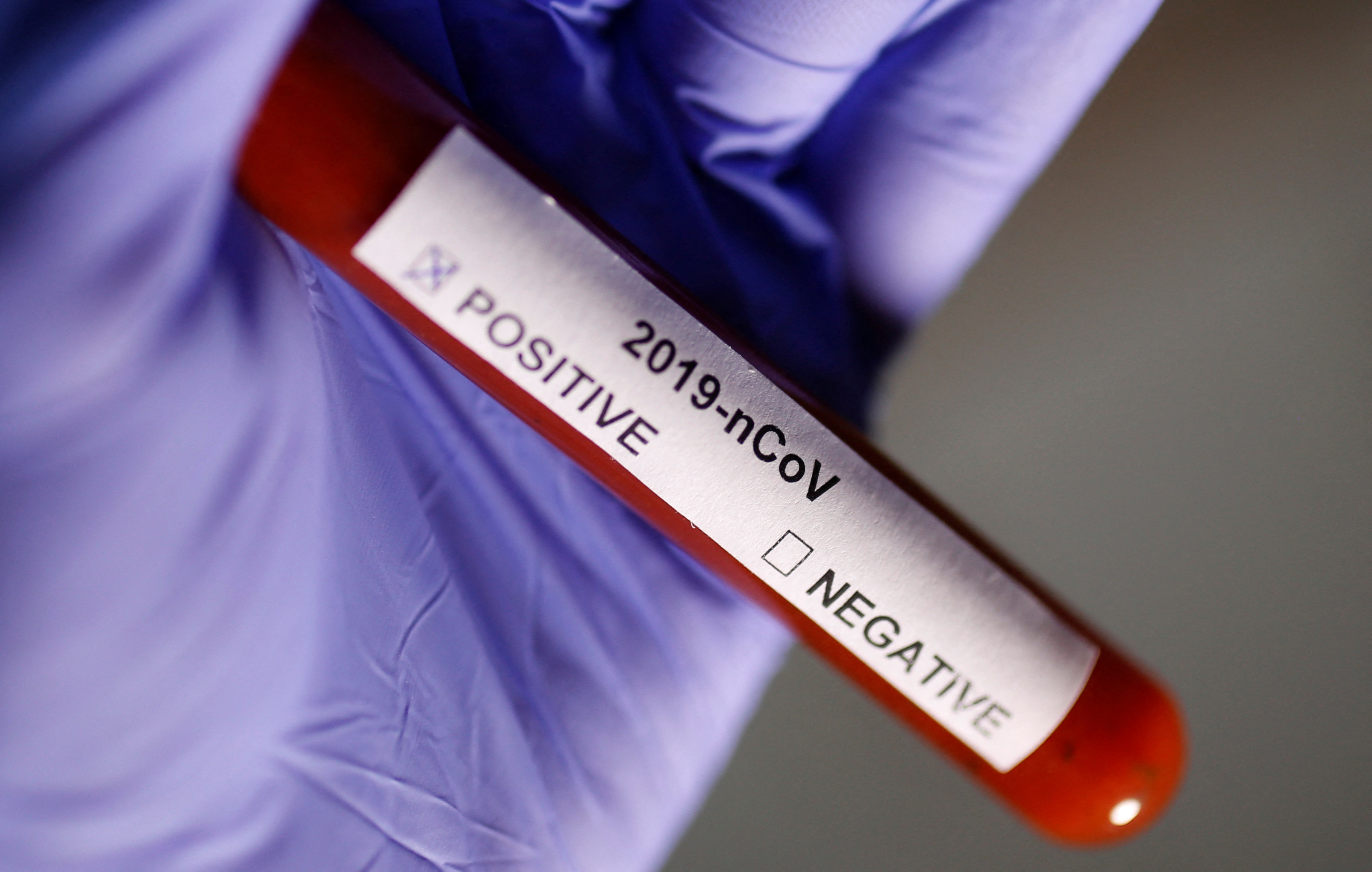 Ivermectin En France