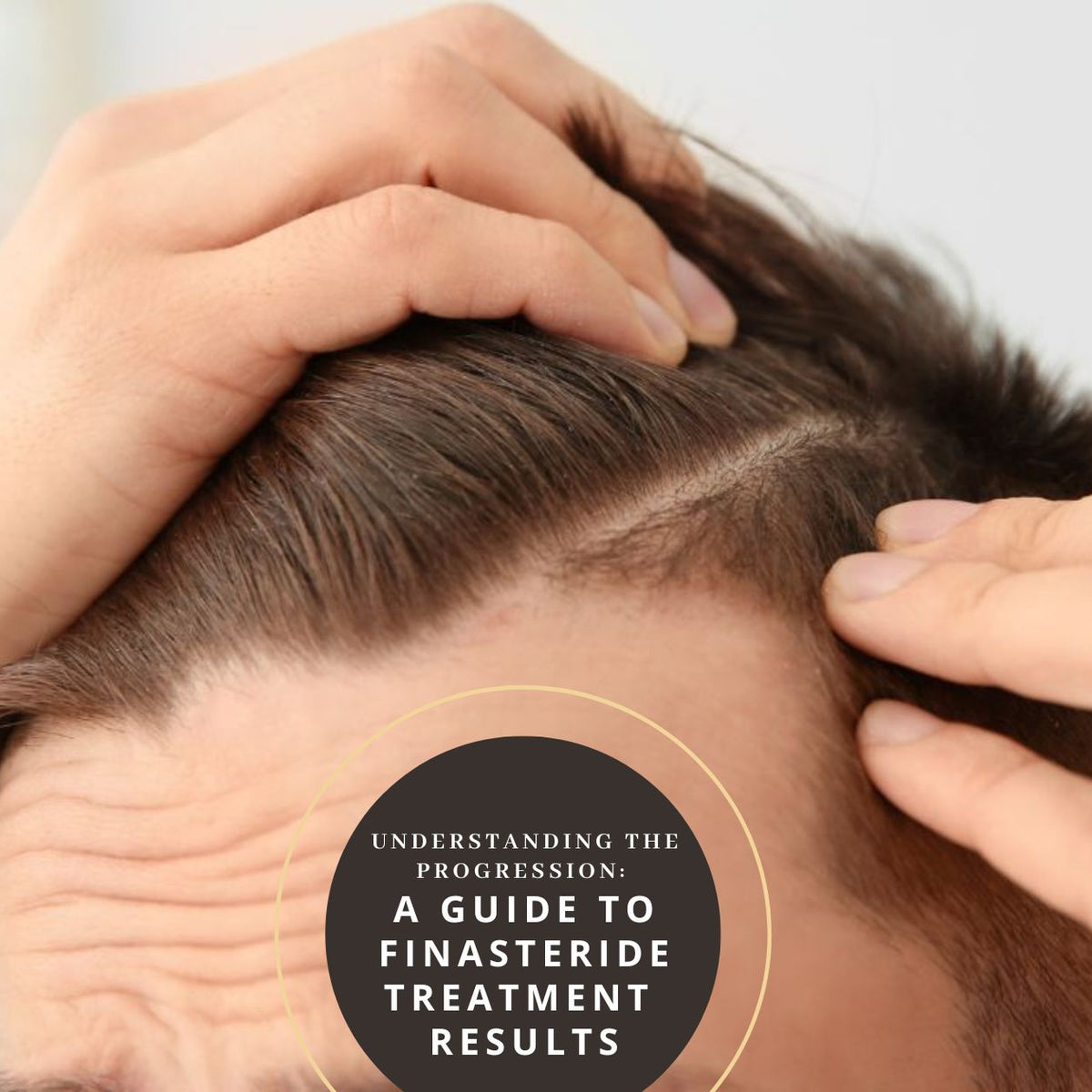prix finasteride mylan