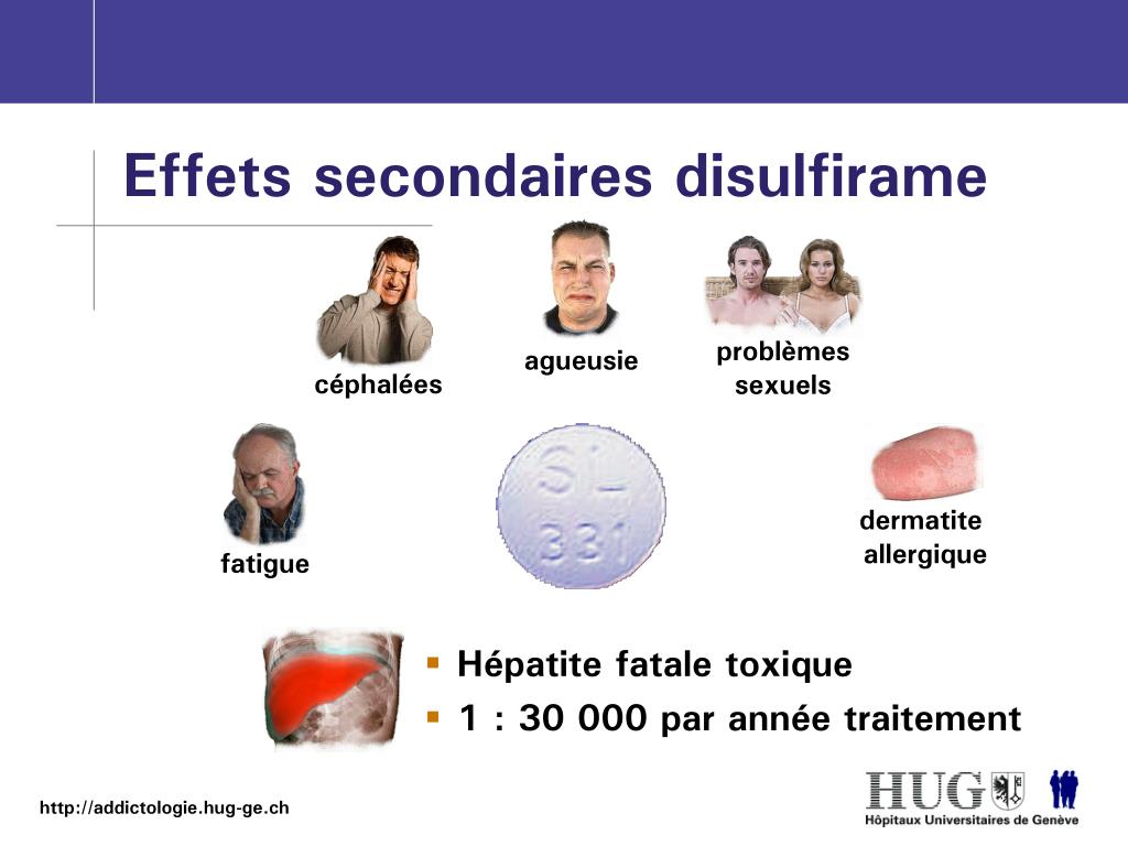 Prix Du Disulfirame