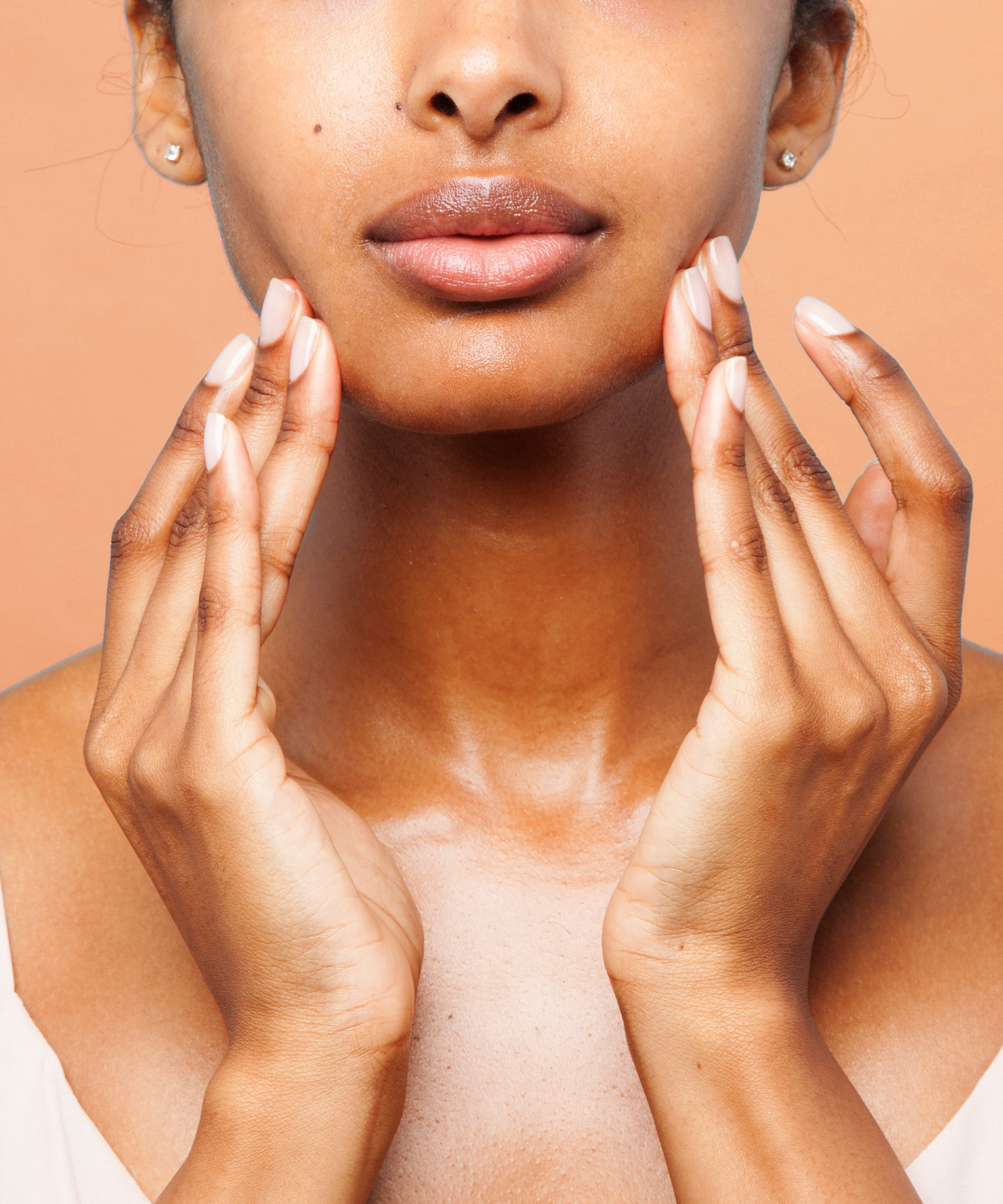 Roaccutane en france