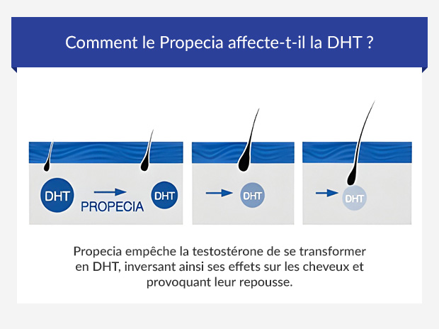 Propecia acheter sans ordonnance