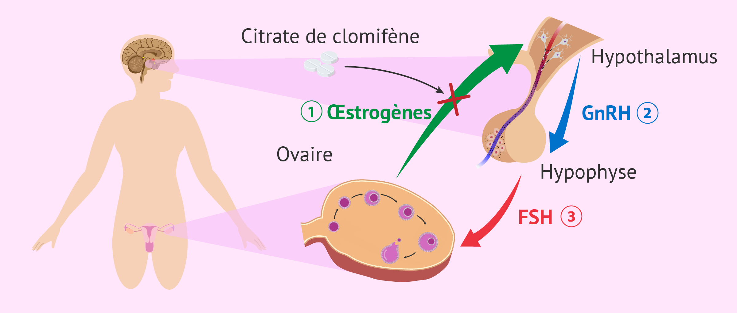 Clomiphène Comment Acheter