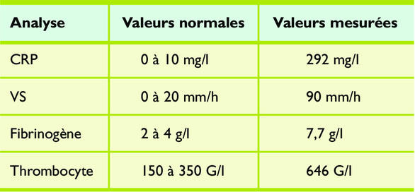 clonazepam le moins cher