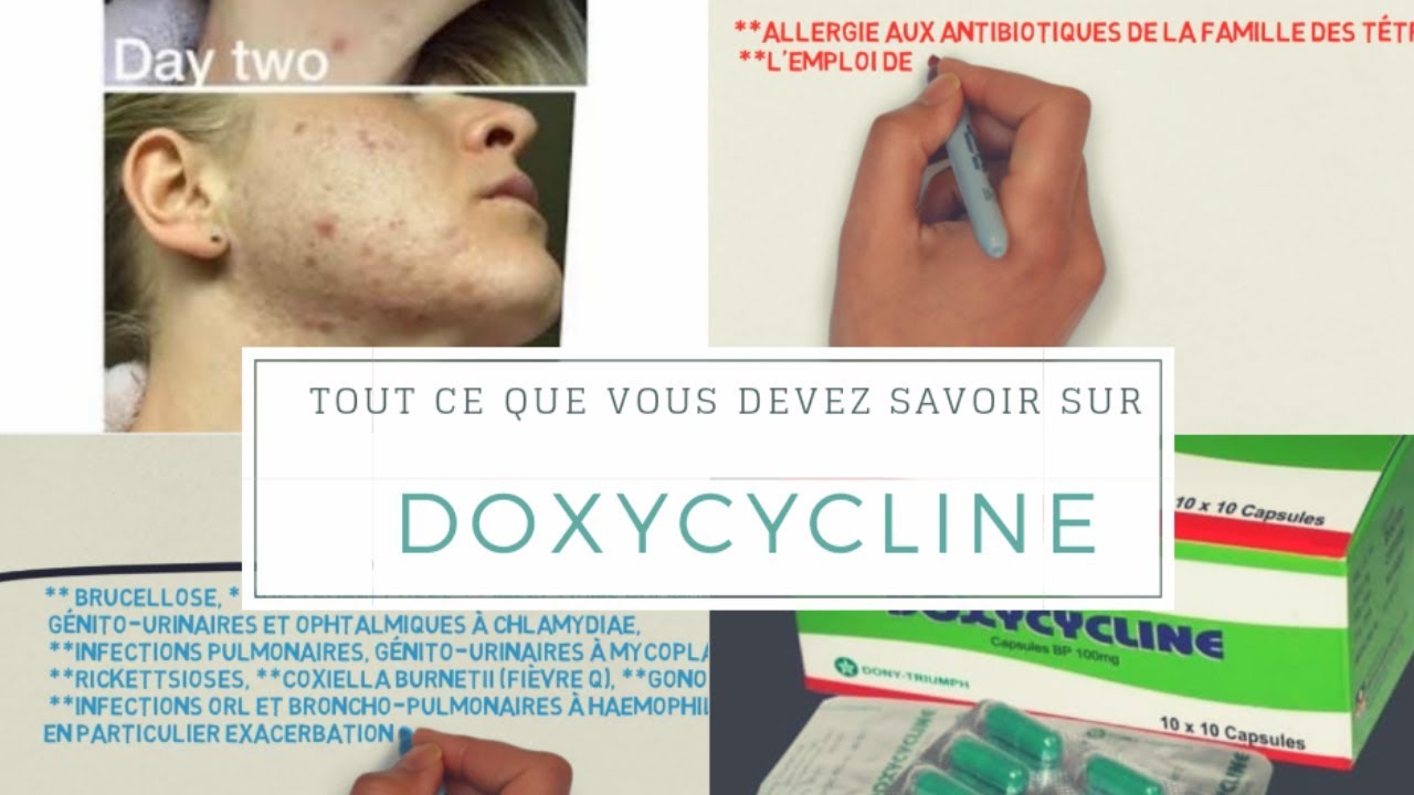 Prix Pour Doxycycline