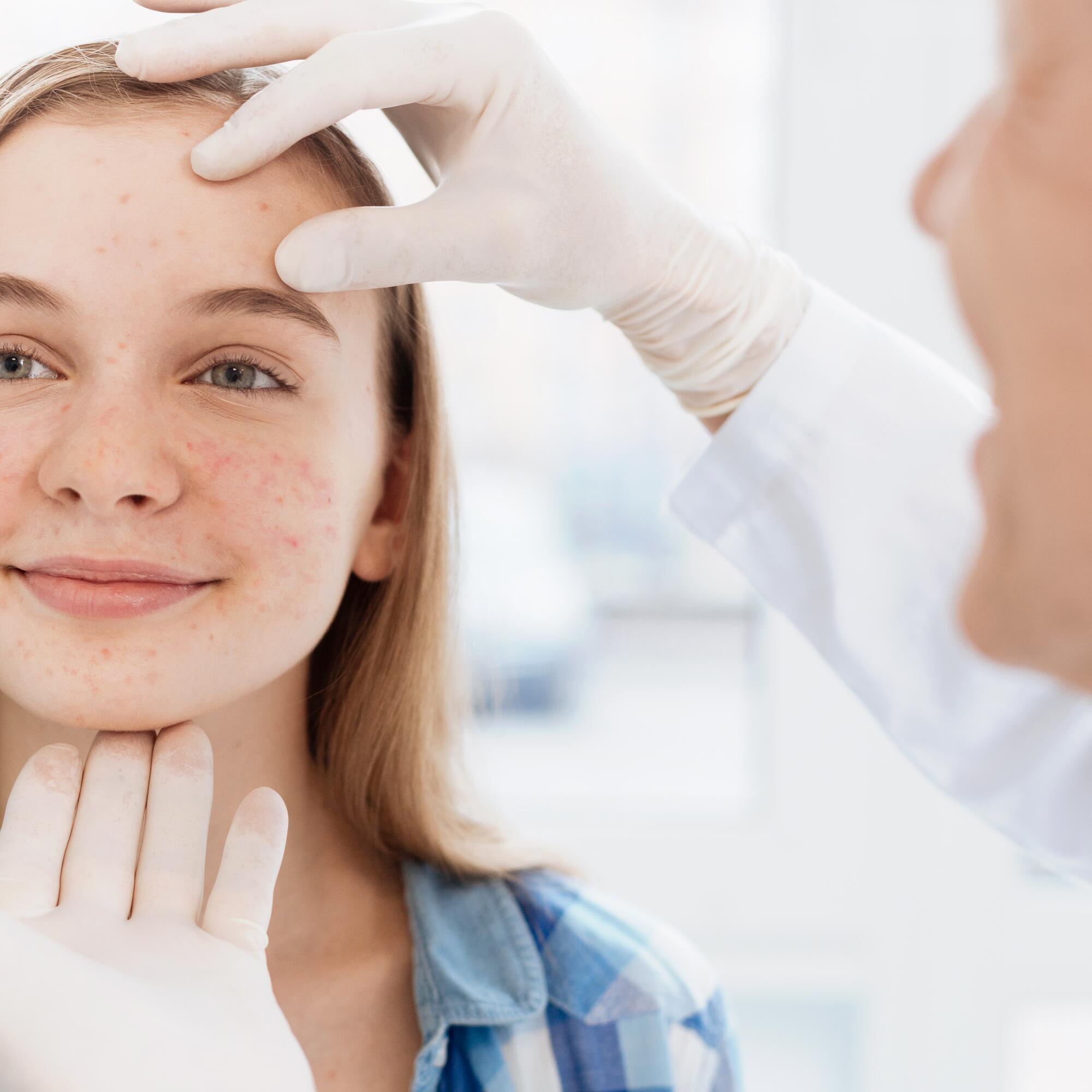 Commander Roaccutane En Ligne