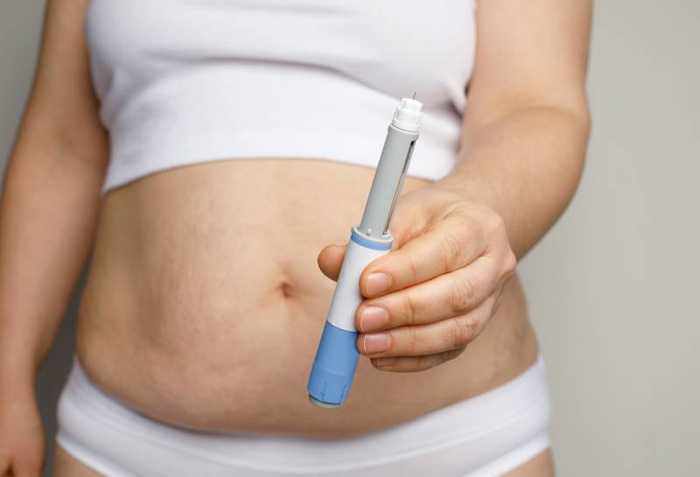 phentermine comment acheter