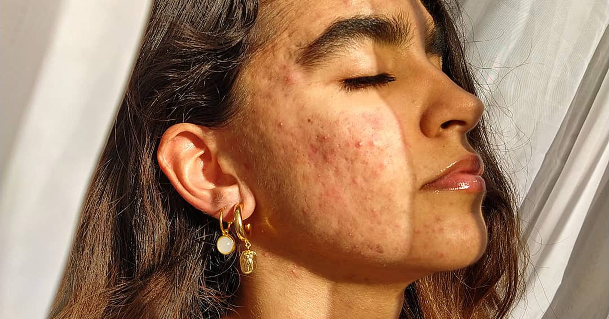 Roaccutane bon marché