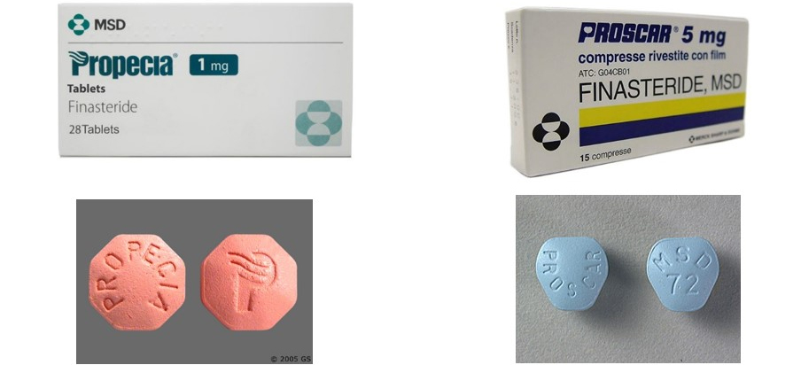 comment acheter du finasteride