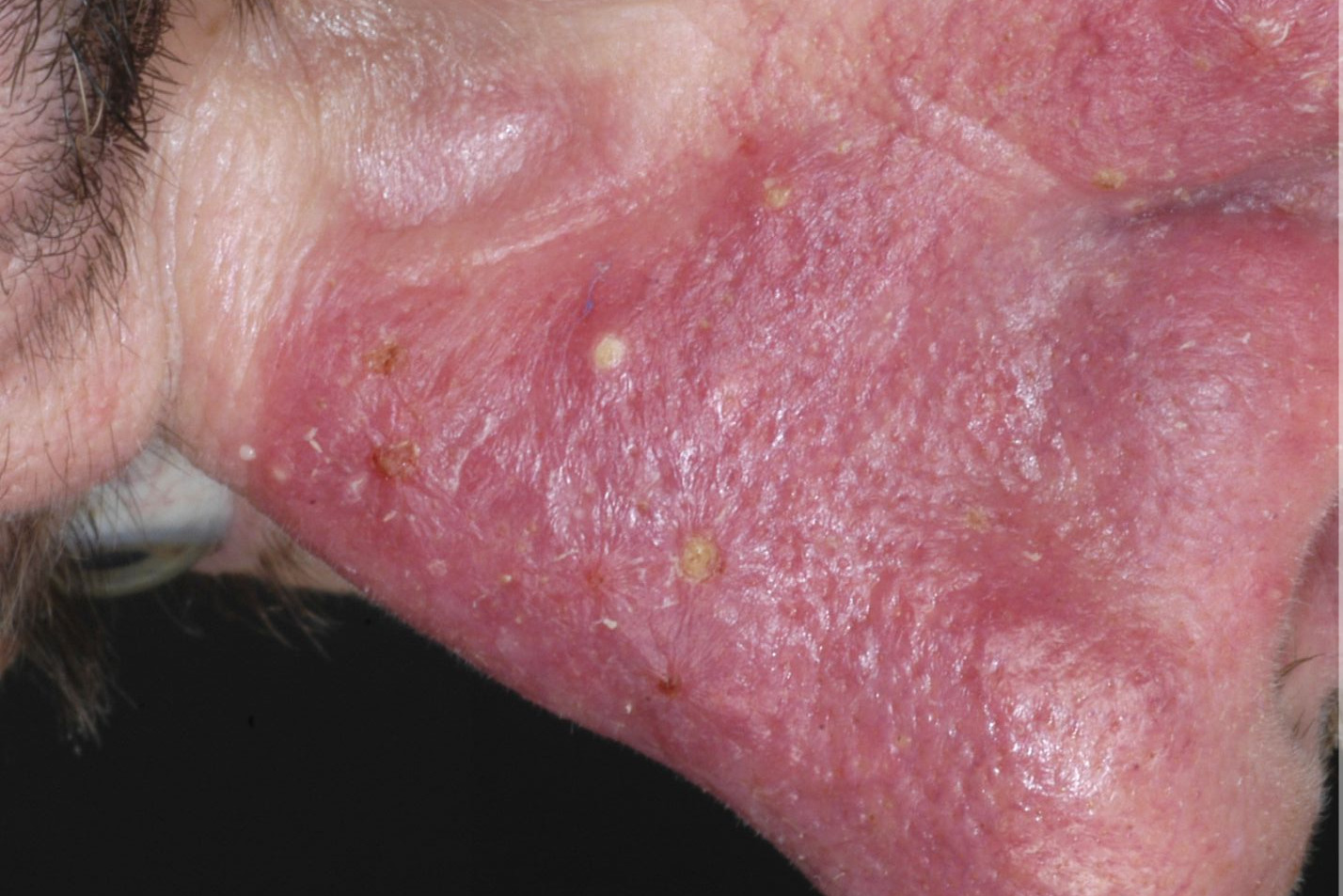 ivermectin pilule