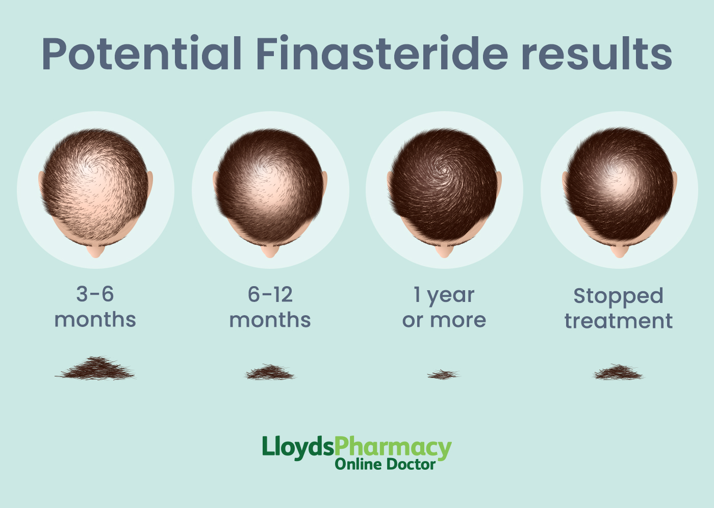 Finasteride Achat Internet