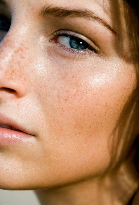 acheter roaccutane sur internet