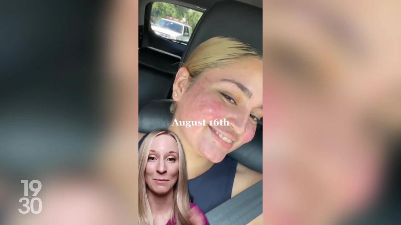 accutane générique