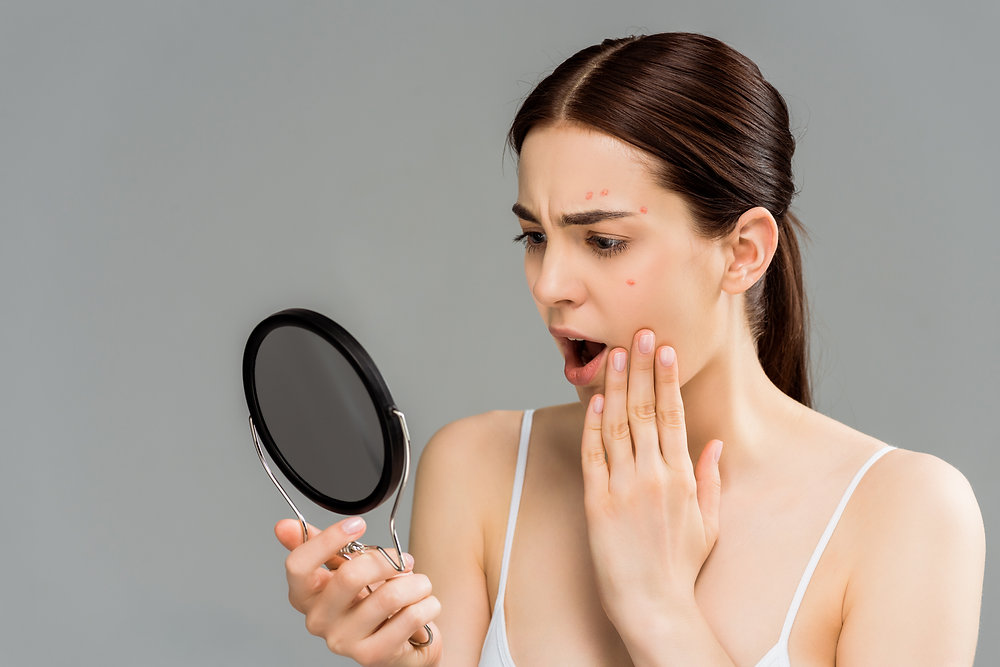 Accutane pilule