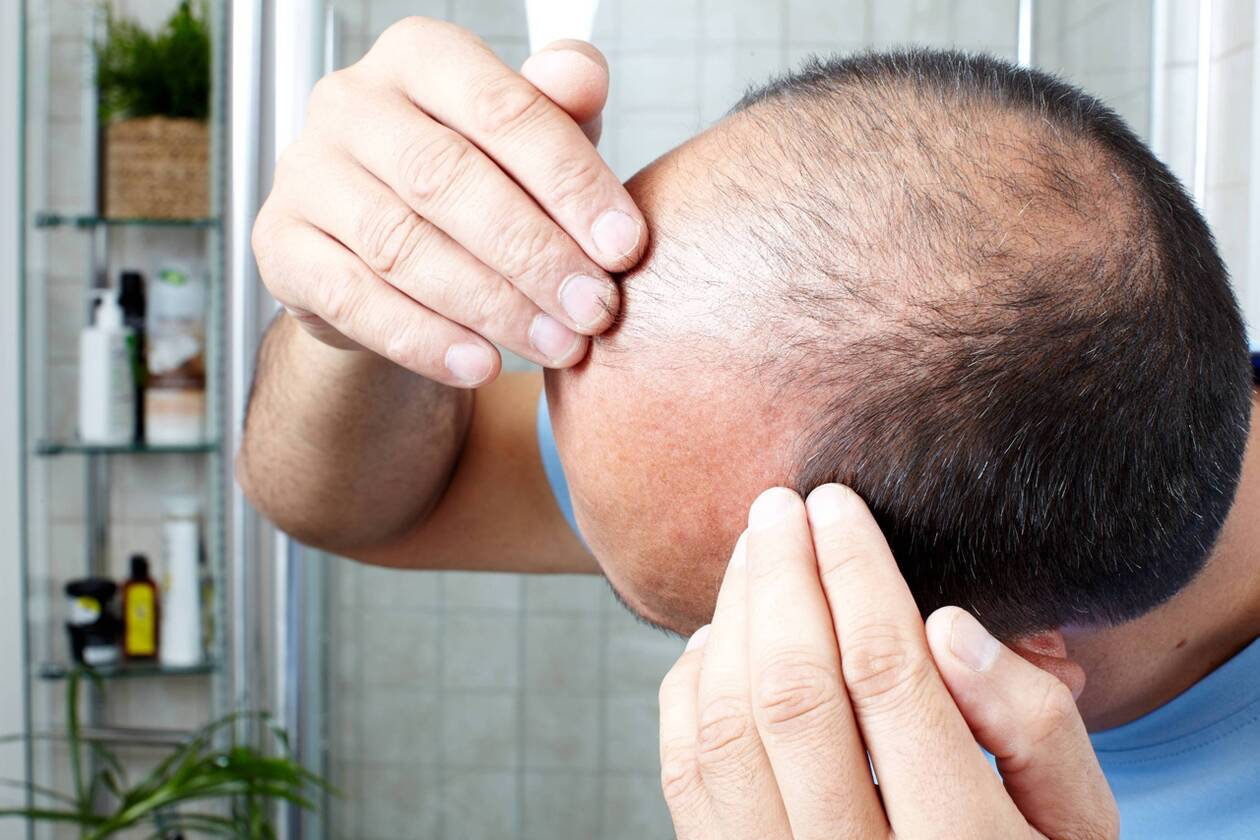 Achat de finasteride