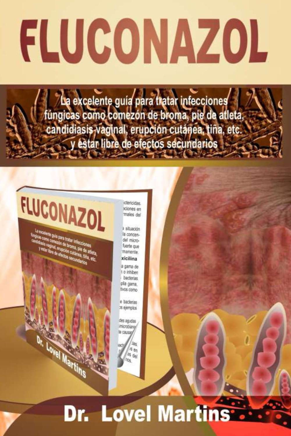 Acheter Fluconazole