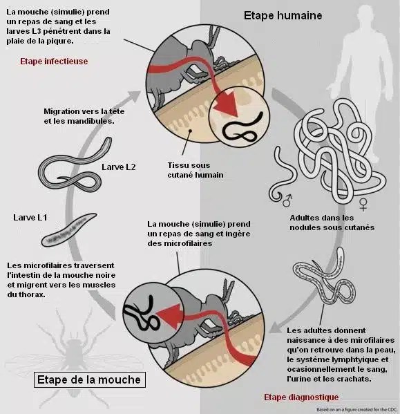 acheter ivermectine en belgique