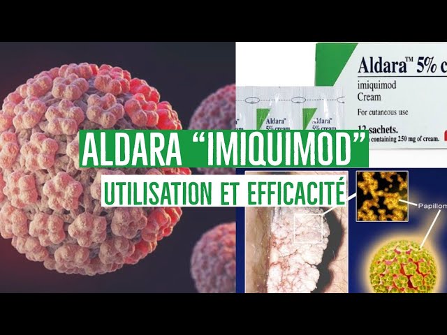 Aldara où acheter