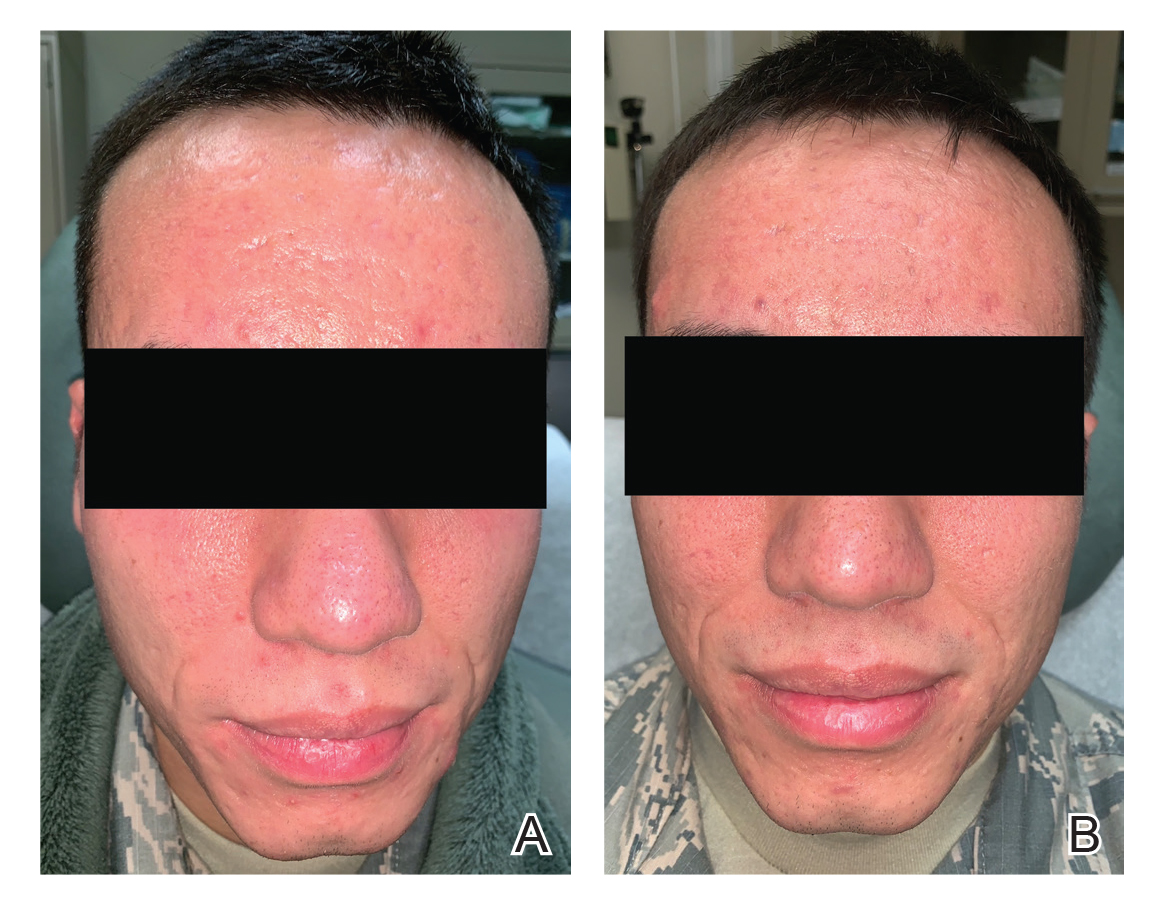 Commander Doxycycline