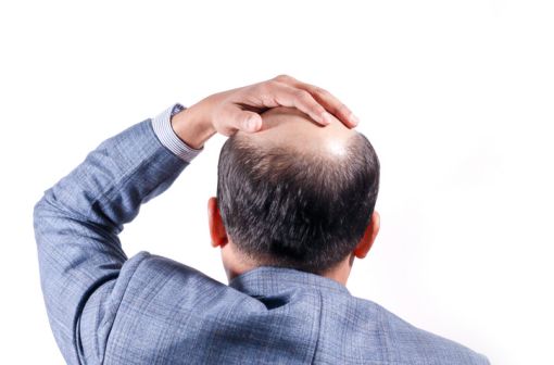 Finasteride 5mg