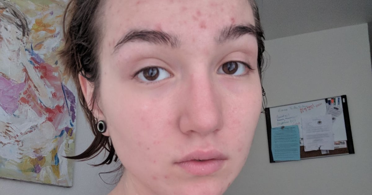 Où Acheter Du Accutane