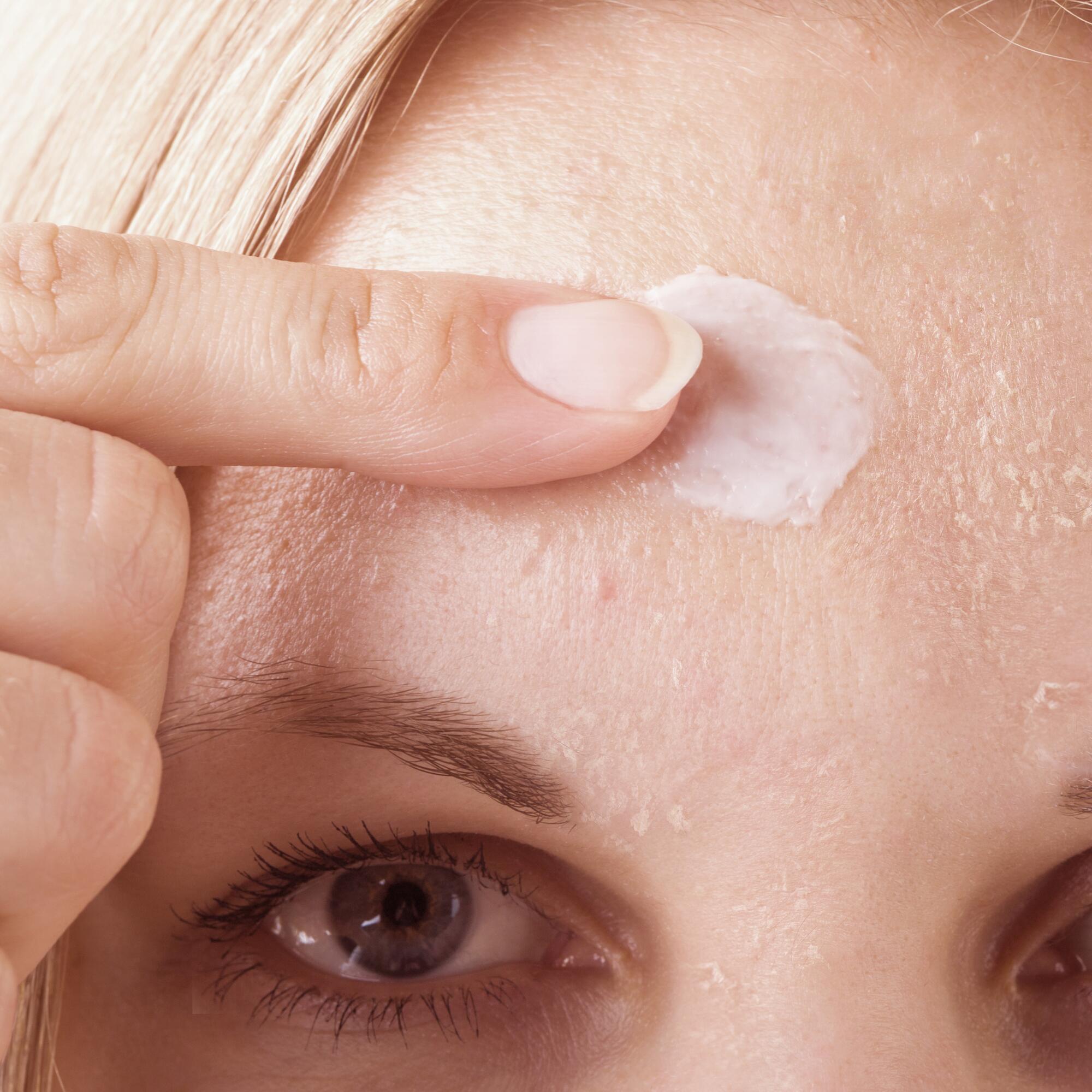 comment se procurer roaccutane sans ordonnance