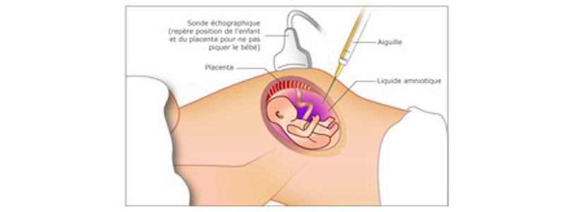 Coût du clomiphene