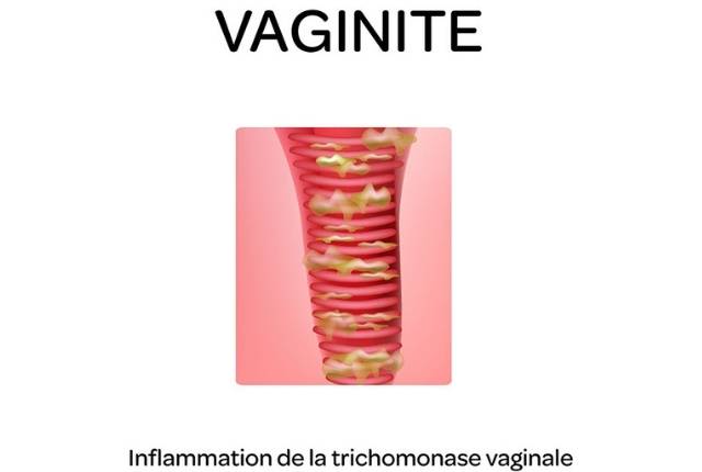 oestrogènes conjugués achat
