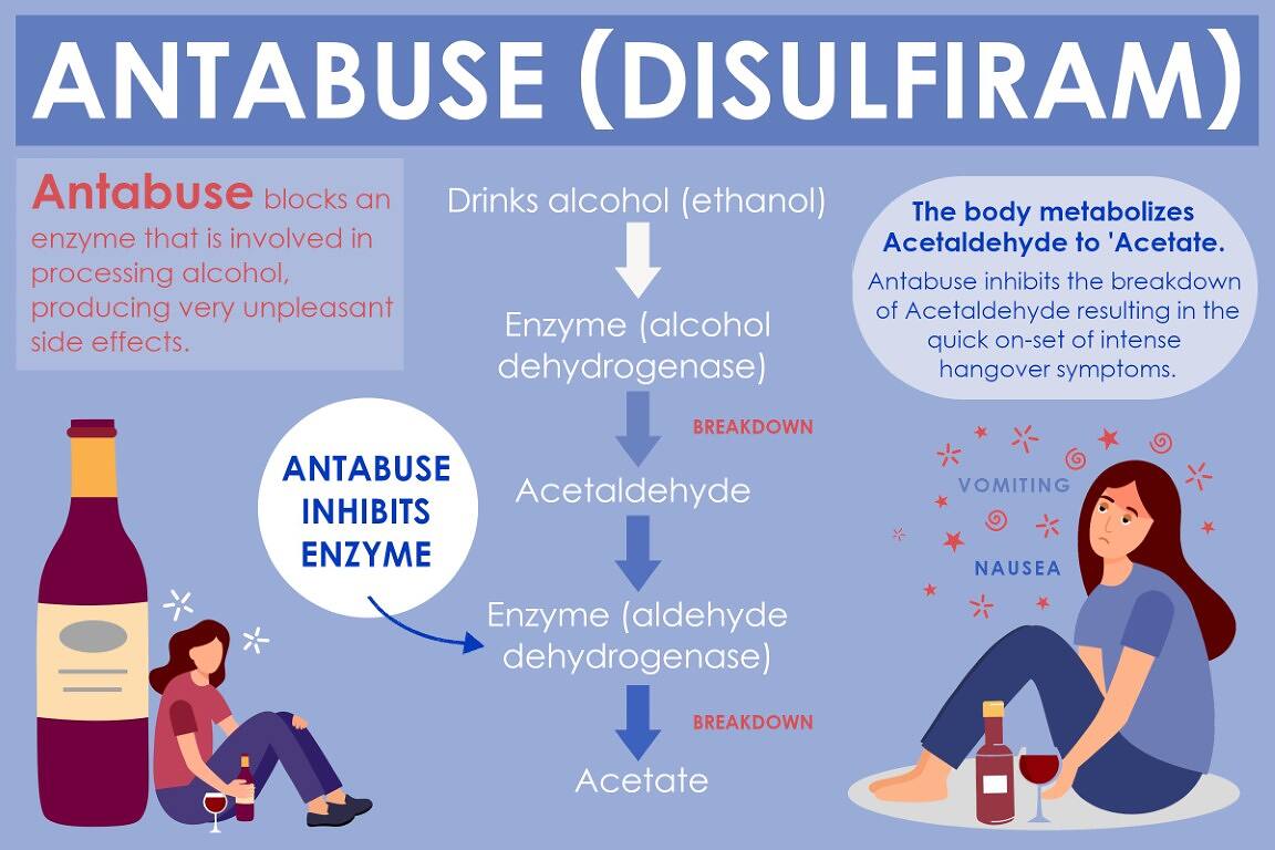 Disulfiram France