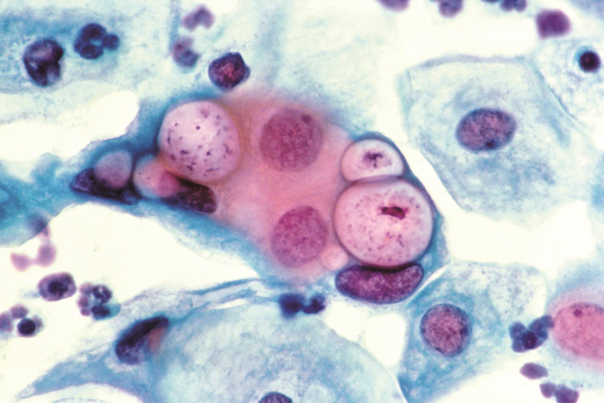 Doxycycline Chlamydia Online