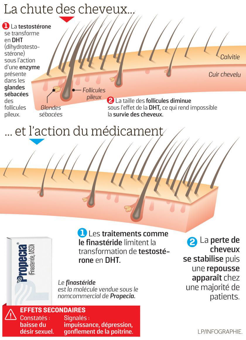 Coût du propecia
