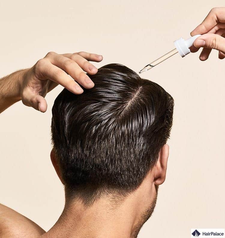 Finasteride Générique Prix