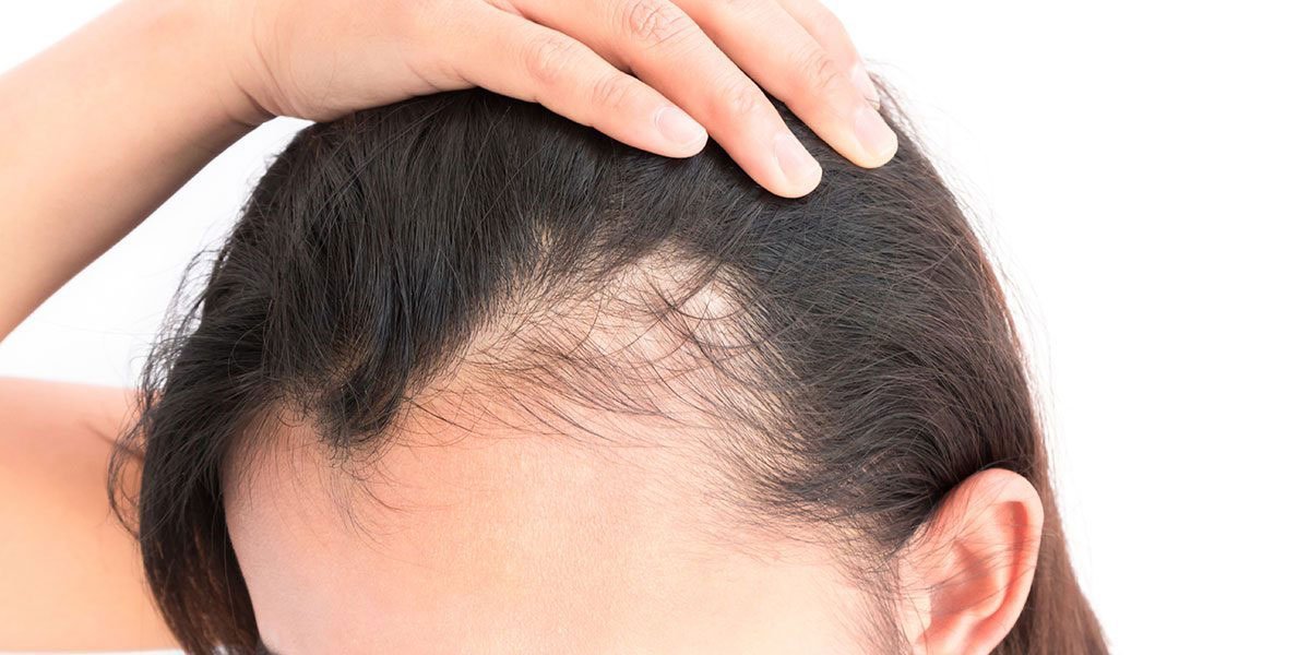 Finasteride Générique Prix