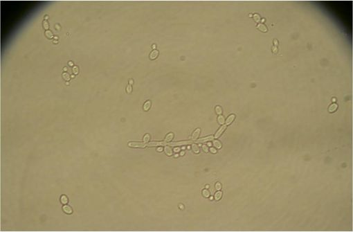 fluconazole in france