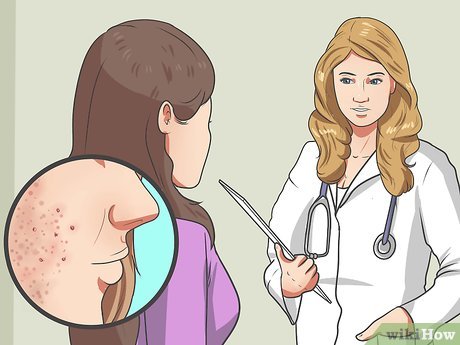 isotretinoin sans ordonnance