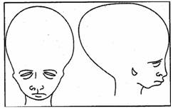 Prix du traitement roaccutane
