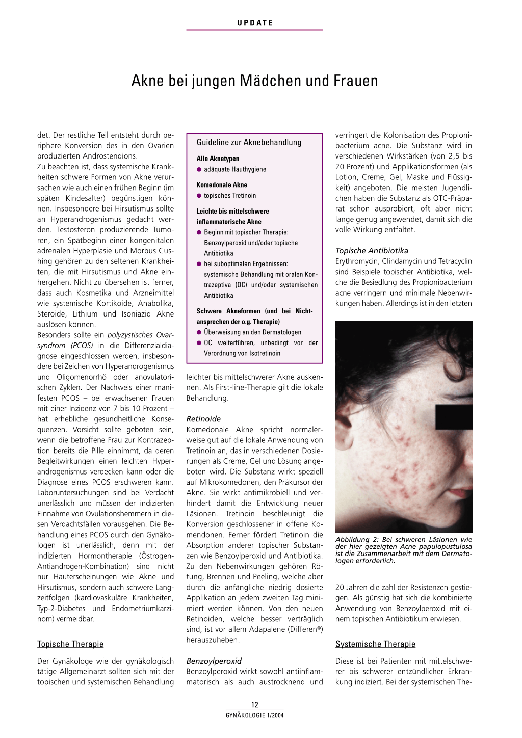 prix roaccutane gel