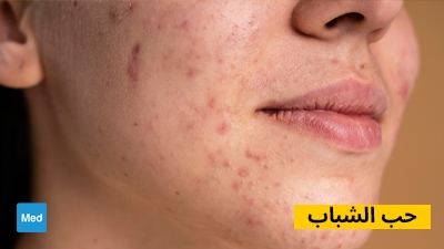 roaccutane medicament prix