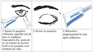 zovirax pommade ophtalmique prix